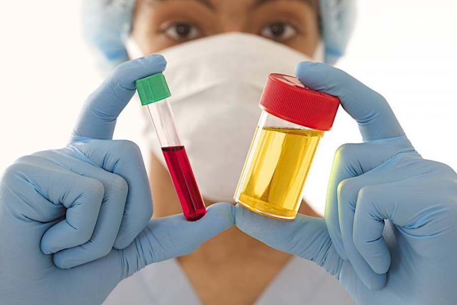 Foto mostrando uma mulher segurando dois frascos um com liquido vermelho e outro amarelo, para explicar a diferença entre cólica renal e infecção de urina.