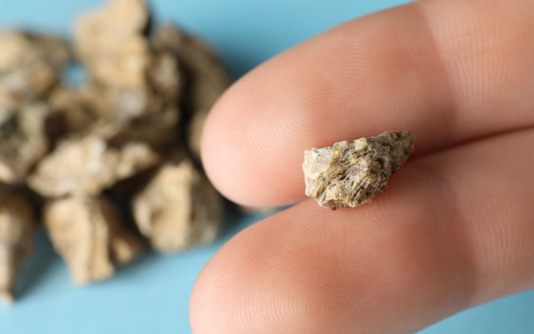 Cólica renal: dos sintomas ao tratamento
