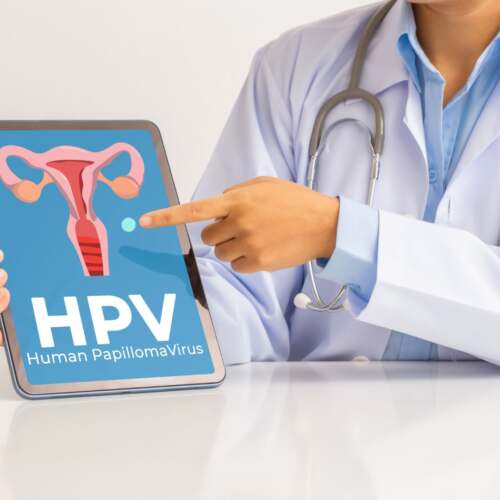 Infecção por HPV